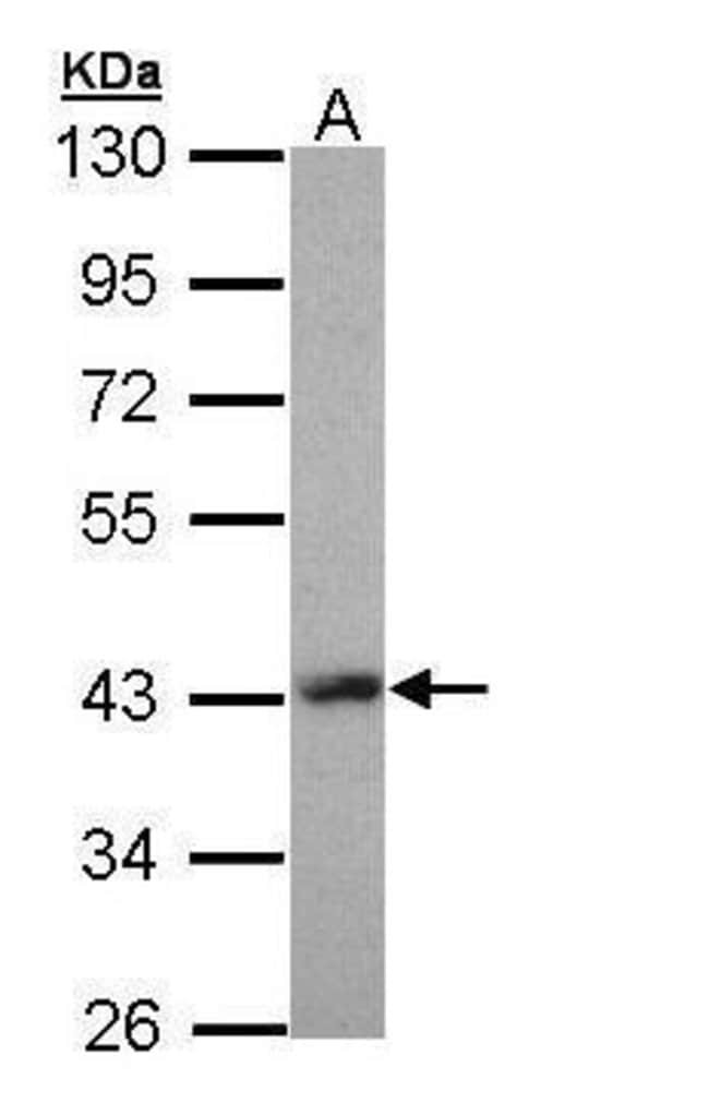 Anti-LIM homeobox protein 8