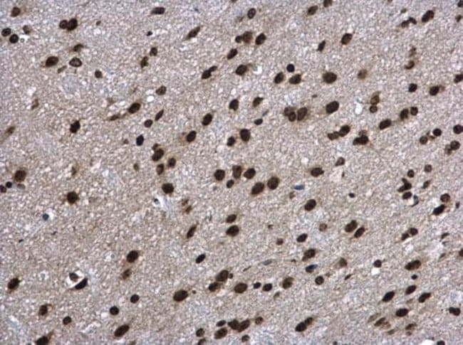 Anti-Aprataxin
