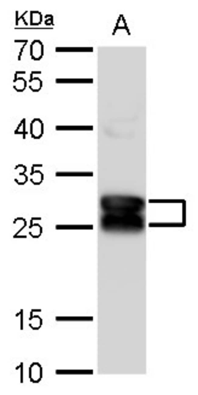 Anti-beta A3 Crystallin