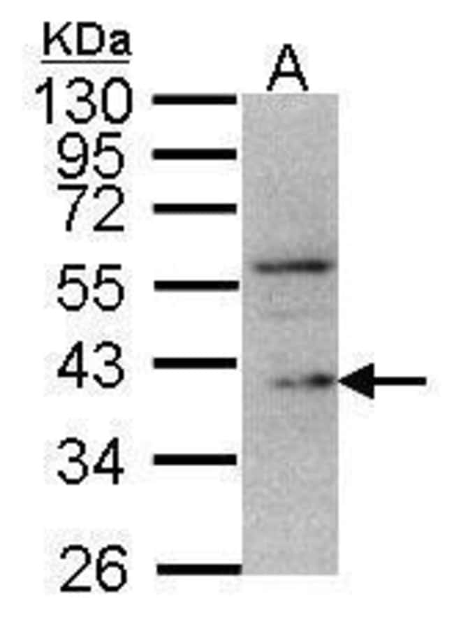 Anti-DUSP12