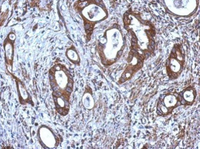 Anti-CNDP1