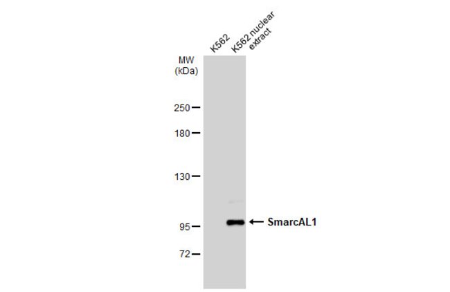 Anti-SmarcAL1