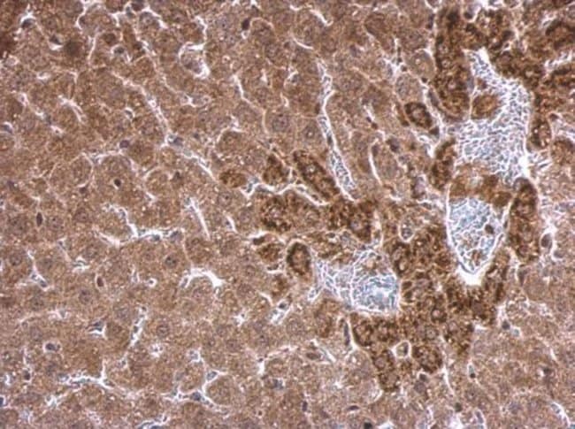 Anti-SREBF chaperone protein