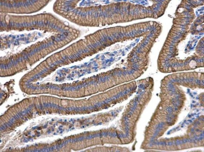 Anti-Cytokeratin 8