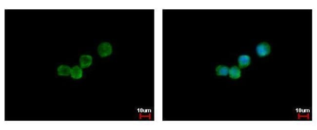 Anti-GCSF Receptor