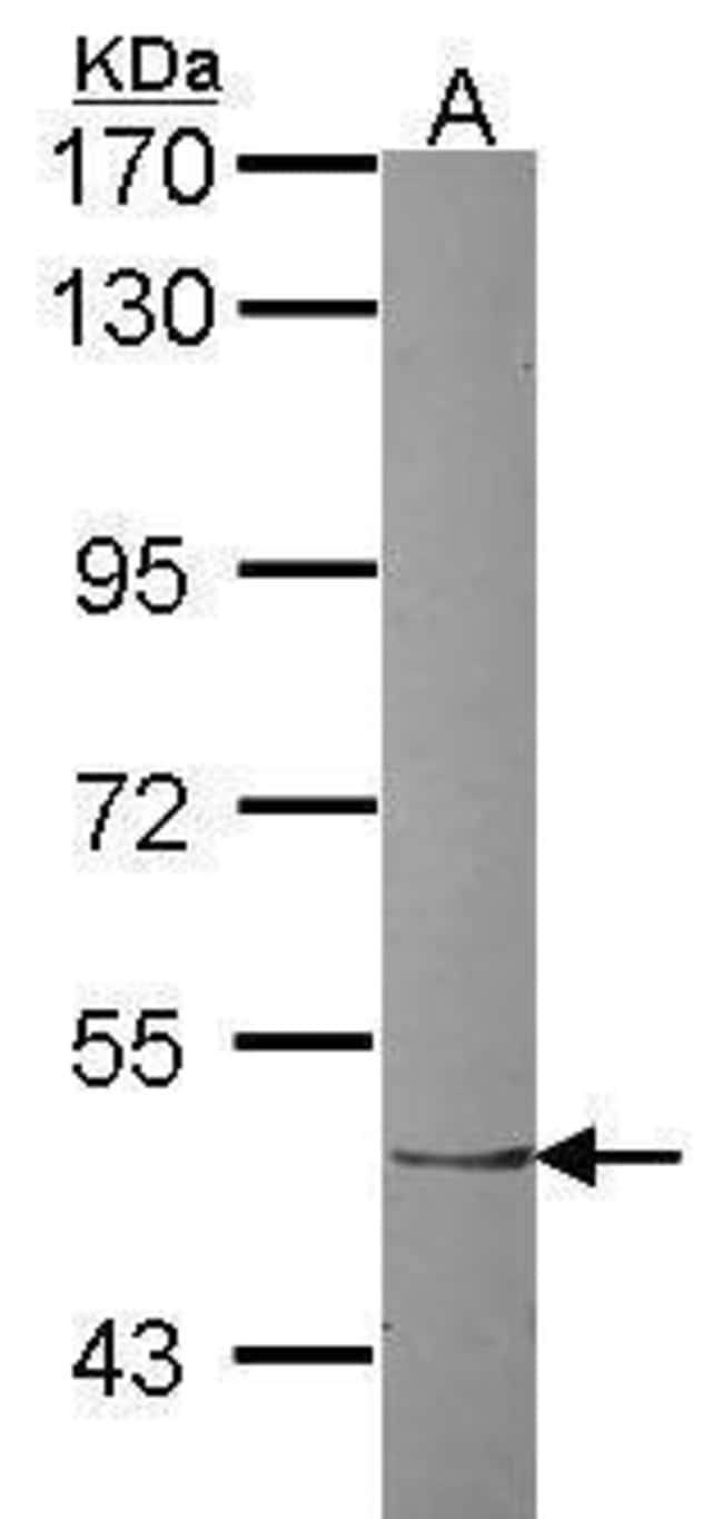 Anti-ZNF212