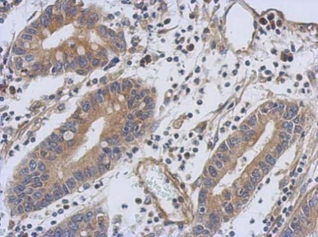 ANTI-TROPONIN T1 (SLOW SKELETAL)