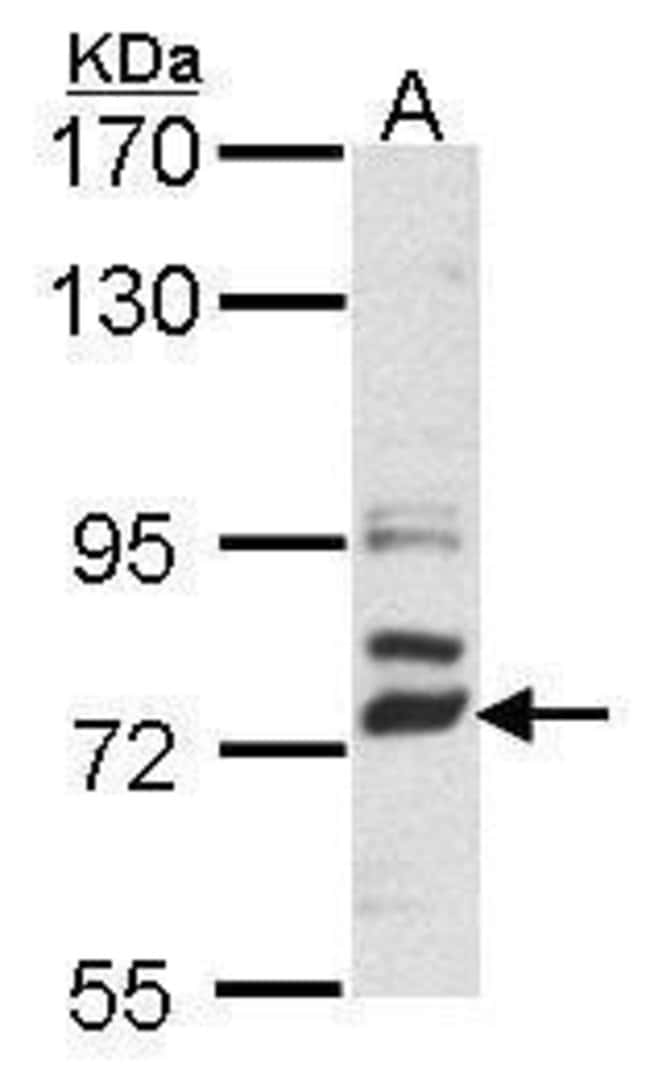 Anti-DLL4