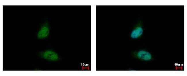 Anti-HDAC3