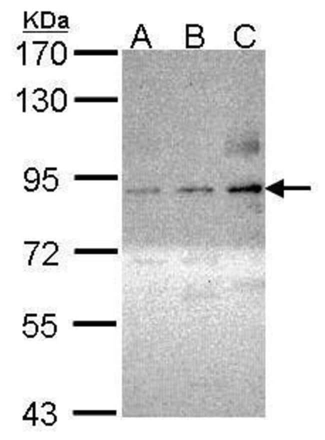 ANTI-PHOSPHO-PKC THETA PSER695
