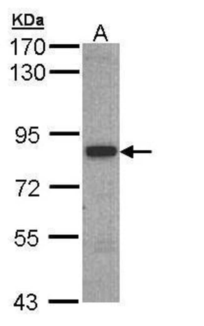 Anti-3BP2