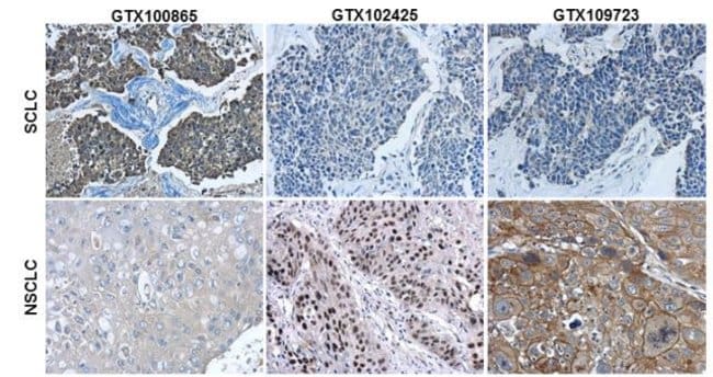 Anti-Cytokeratin 7