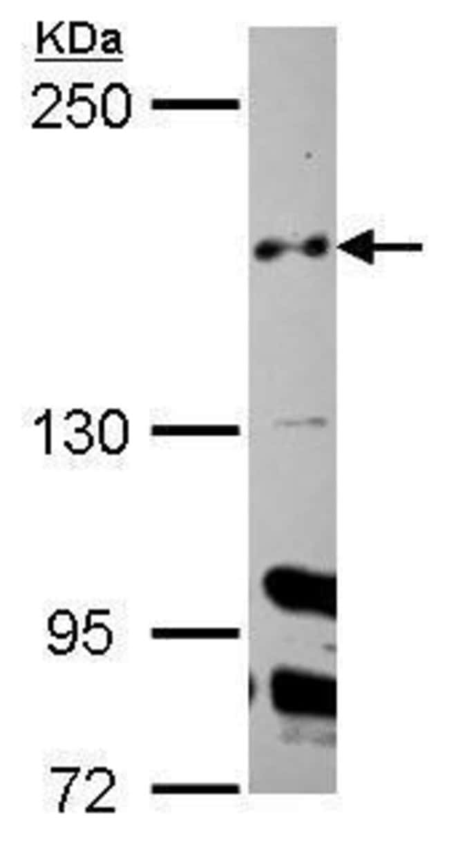 Anti-CUL-7