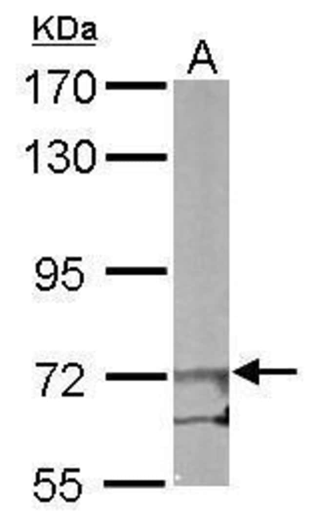 Anti-EIF2B epsilon