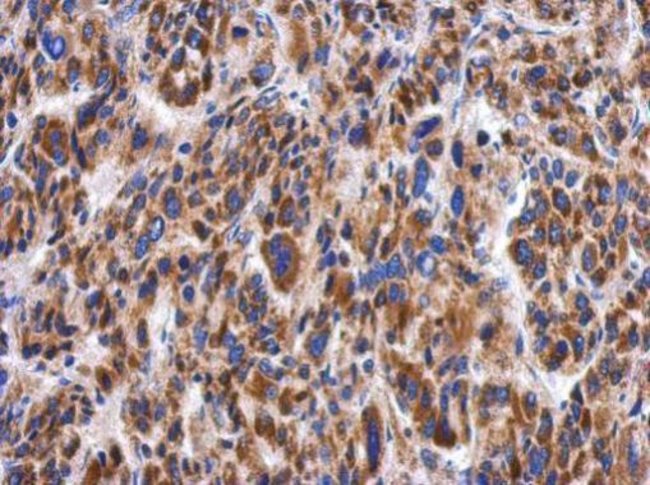 Anti-Myotilin