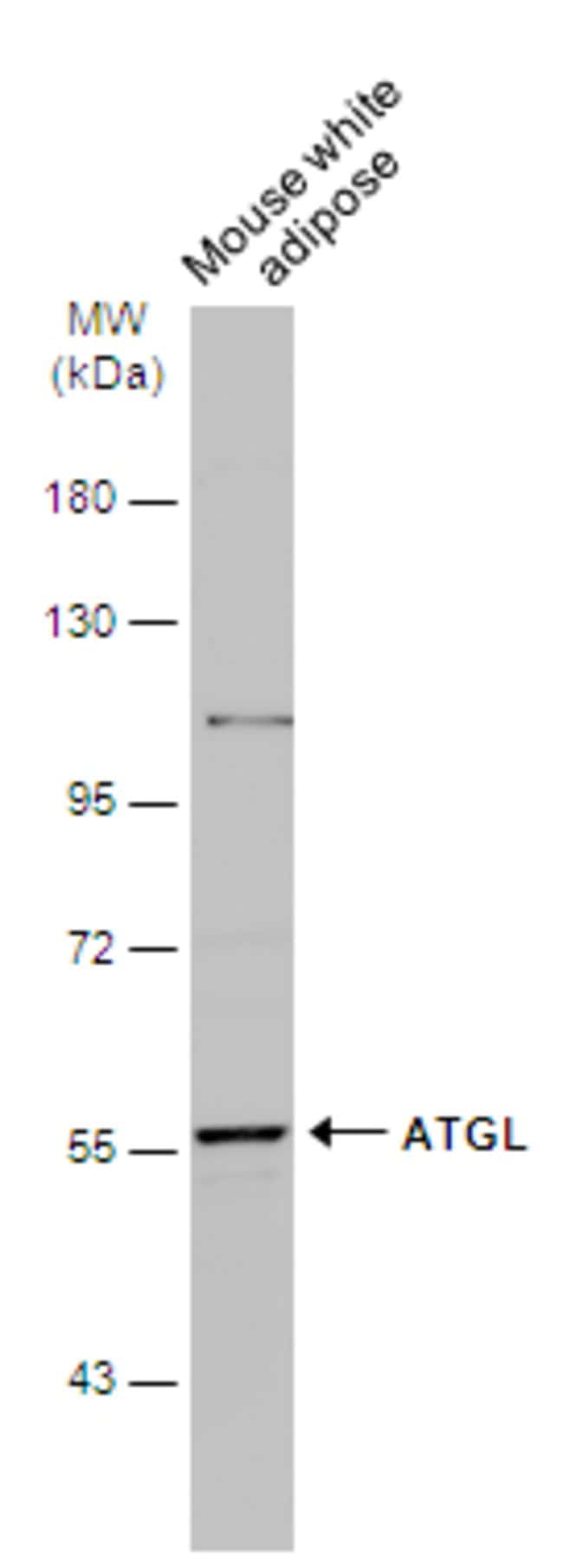 Anti-PNPLA2