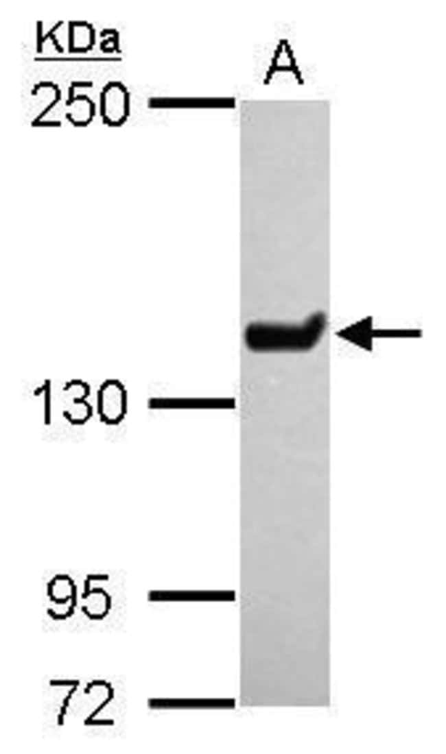 Anti-JARID1C