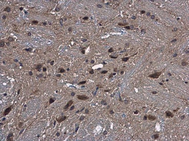 Anti-Cytochrome P450 2R1