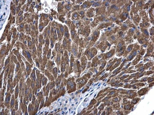 Anti-ALDH5A1