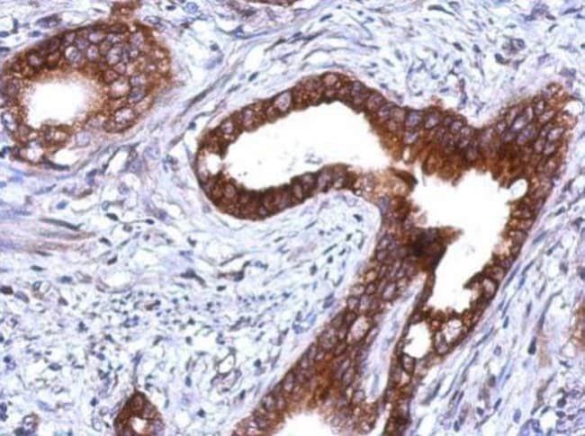 Anti-Plakophilin 1