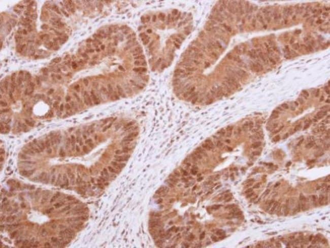 Anti-HDAC4