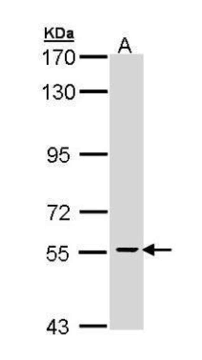 Anti-Parafibromin