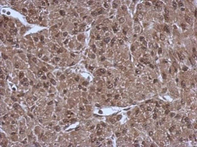 Anti-PSMC3
