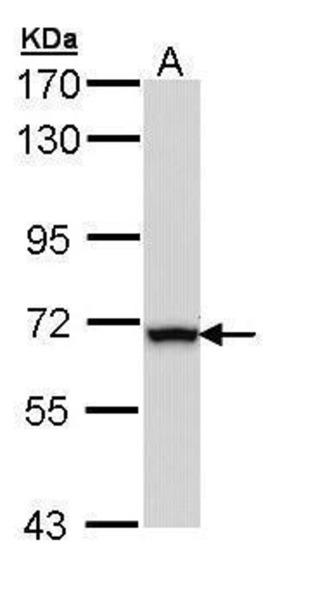 Anti-ALDH4A1