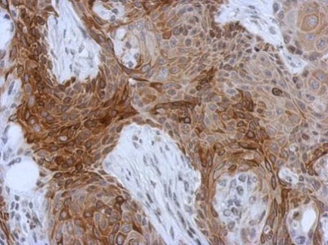 Anti-Cytokeratin 13