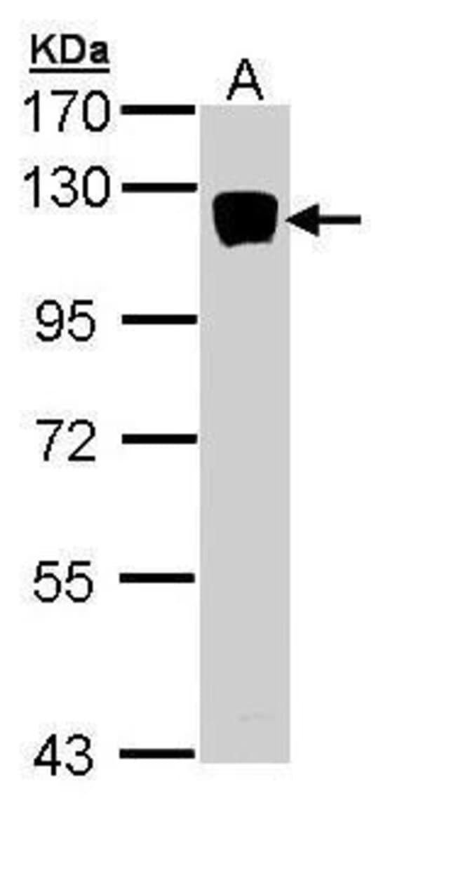 Anti-Xylosyltransferase II
