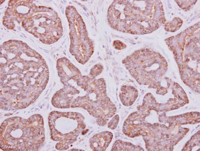 Anti-PYGM