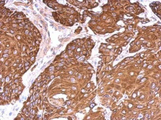 Anti-Cytokeratin 6B