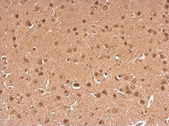 Anti-gamma Synuclein