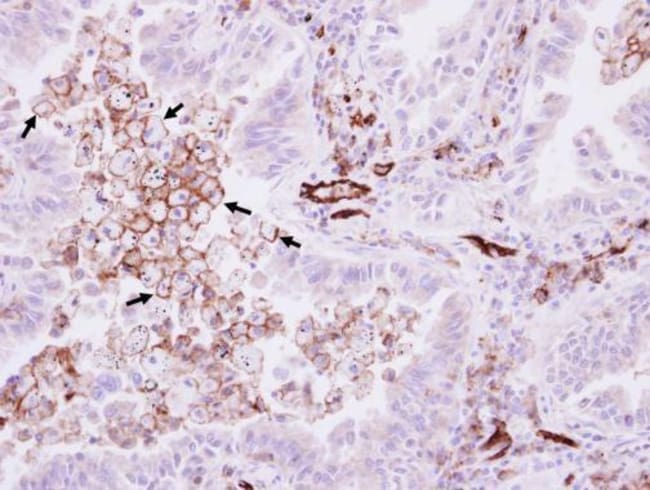 Anti-CD31