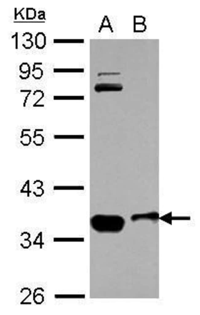 Anti-OSTM1