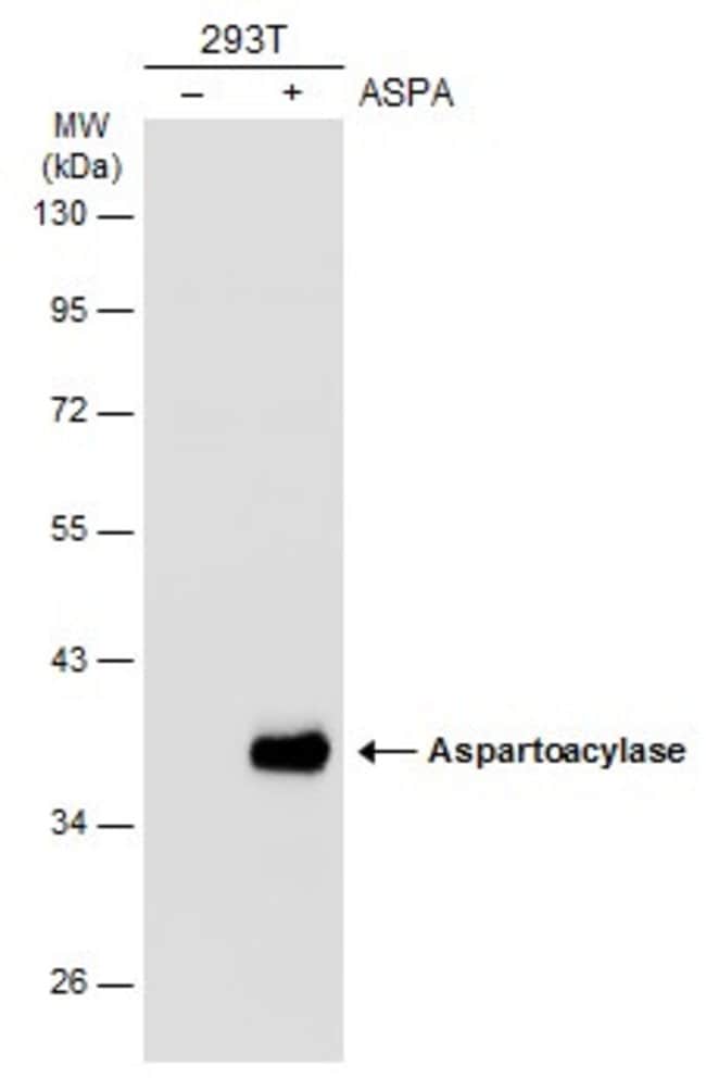 Anti-Aspartoacylase