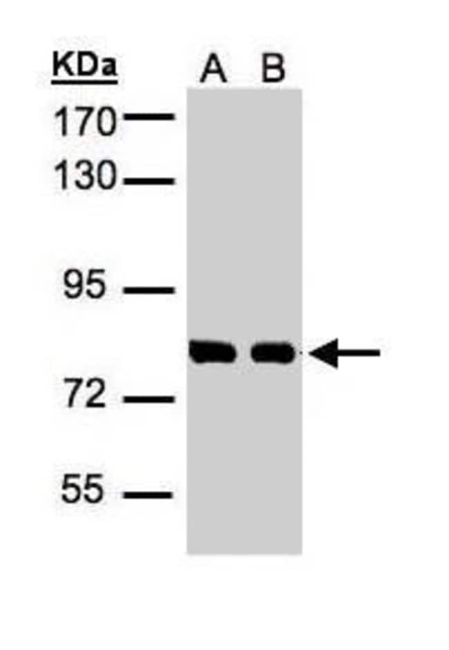 Anti-HEC1