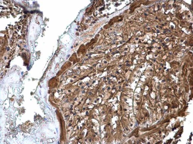 Anti-ATP6V1A