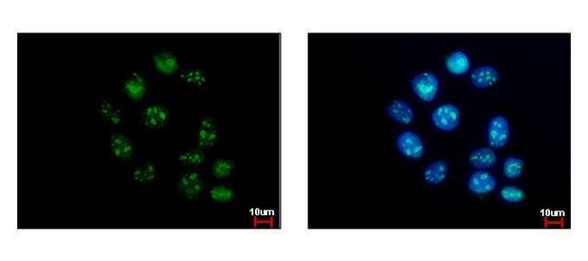 Anti-GTPBP4