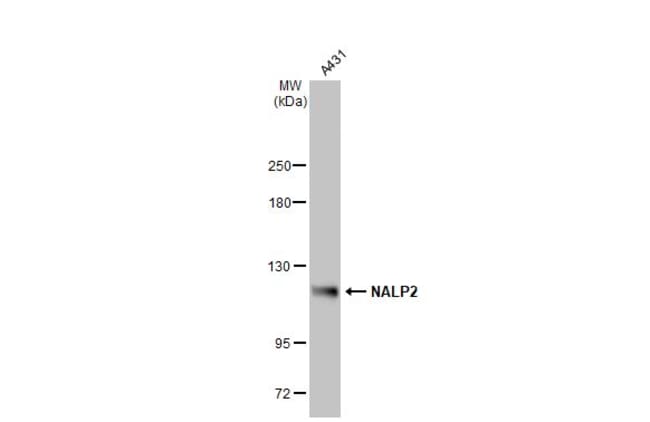Anti-NALP2