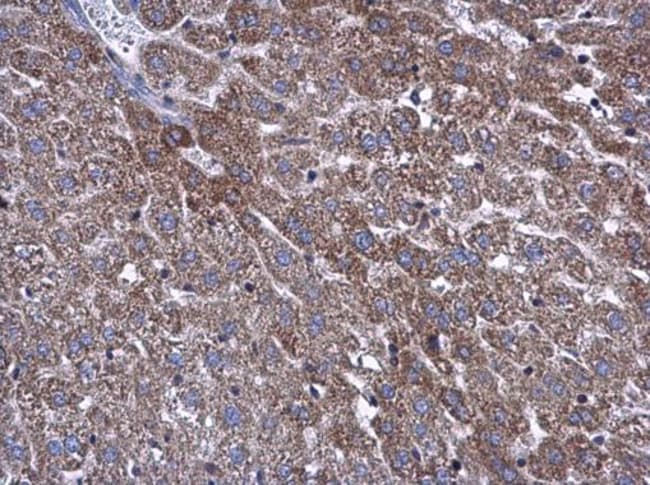 Anti-ATP5L