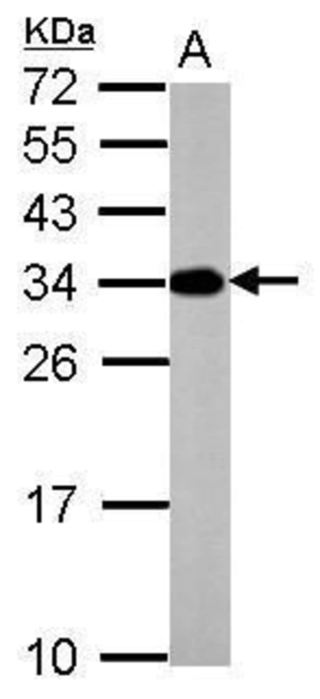 Anti-ATP6V1E2