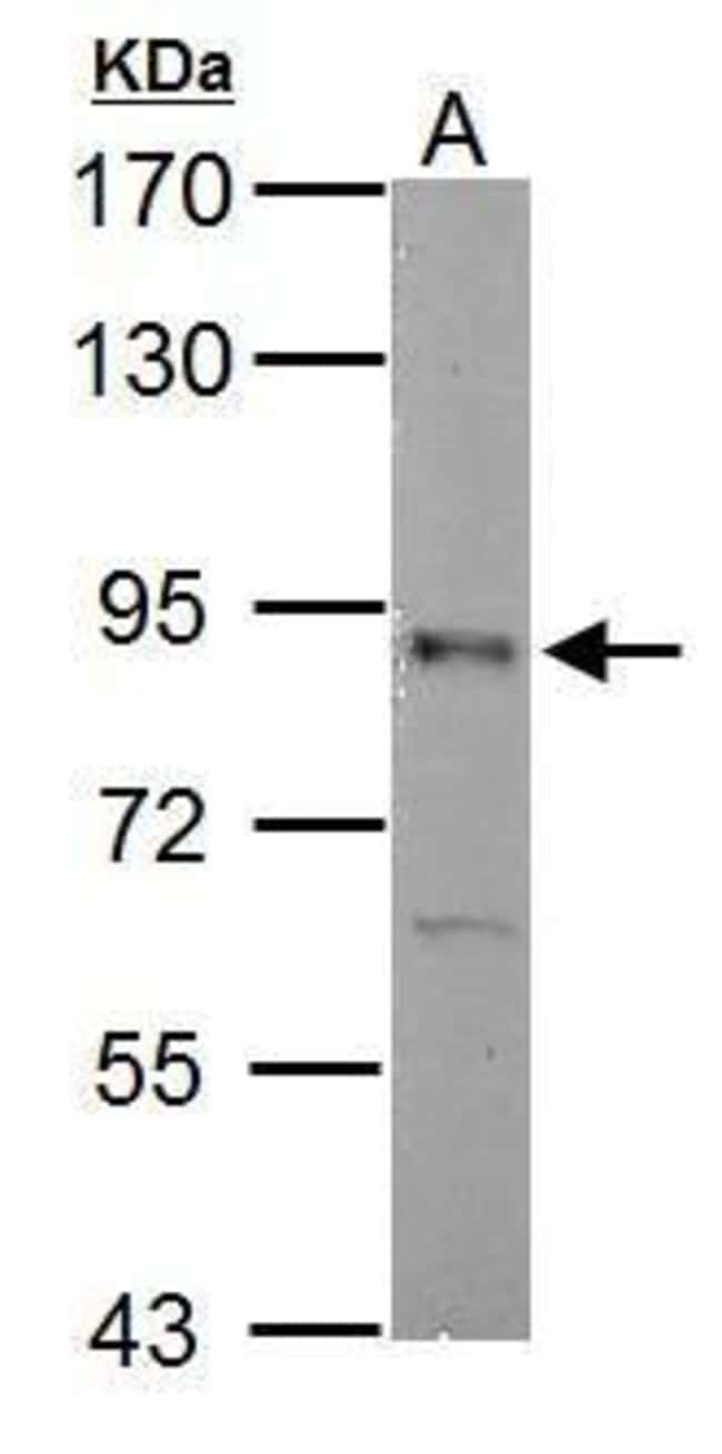 Anti-RSK2