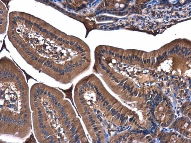Anti-PI3 kinase p85 alpha