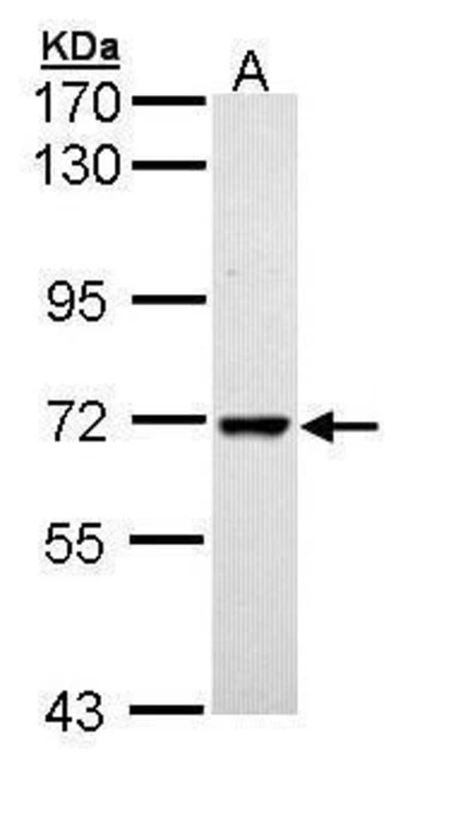 ANTI-PEPTIDYLPROLYL ISOMERASE-LIKE 2 ISO