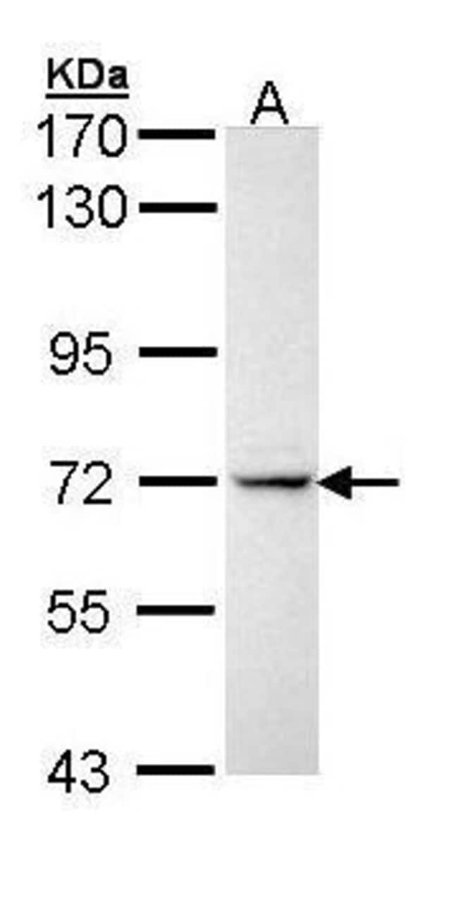 Anti-IL1 Receptor 1