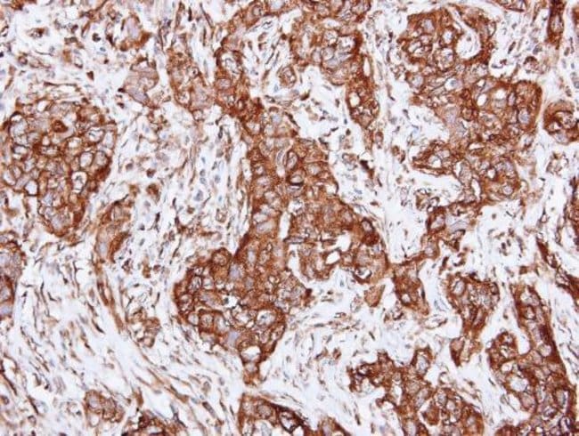 Anti-alpha Actinin 2