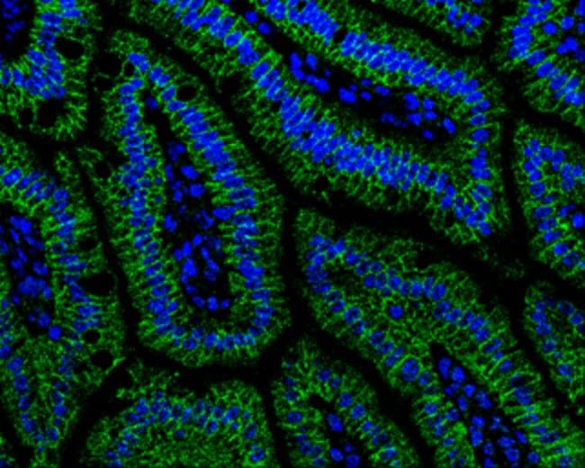 Anti-alpha Catenin