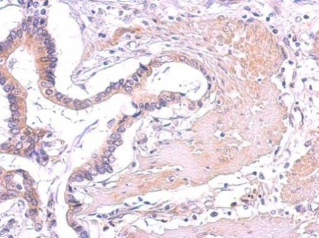 Anti-PLCG2