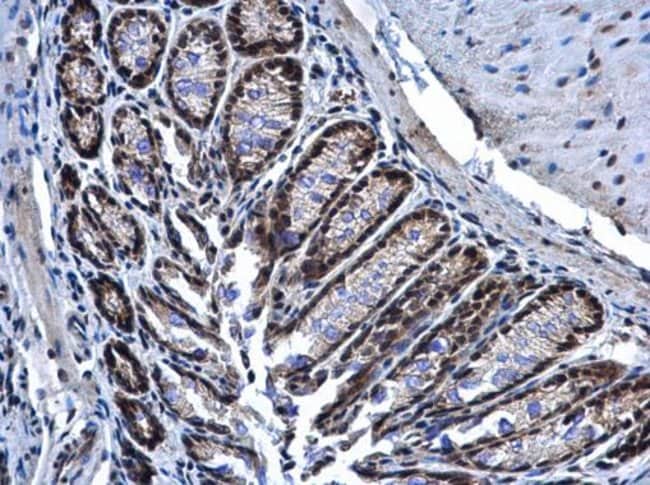 Anti-PRP19